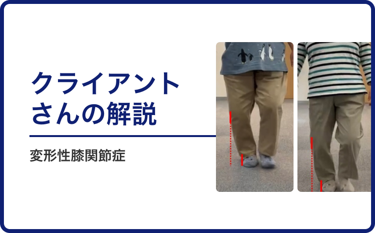 変形性膝関節症のクライアントの解説