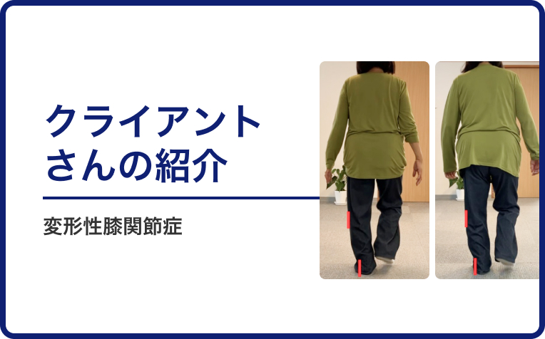 変形性膝関節症のクライアントさんの改善例の紹介