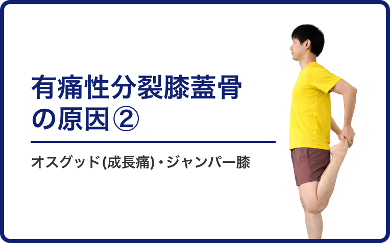 有痛性分裂膝蓋骨の原因②