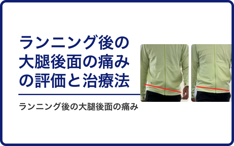 ランニング後の大腿後面の痛みの評価と治療法