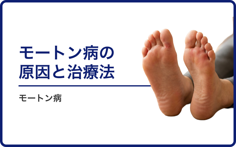 足裏の痛み「モートン病」の原因と治療法