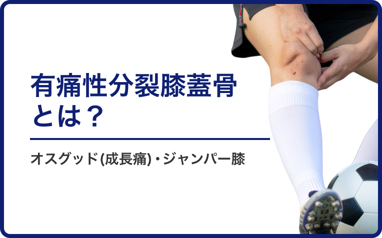 有痛性分裂膝蓋骨とは