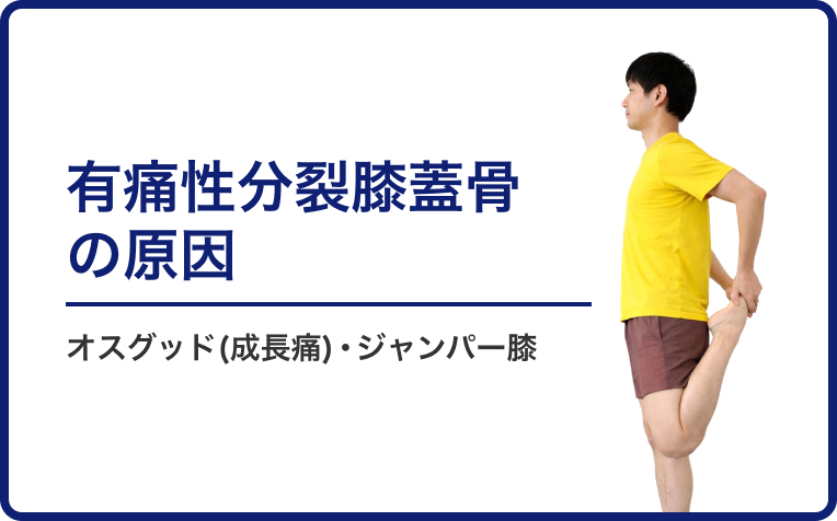 有痛性分裂膝蓋骨の原因