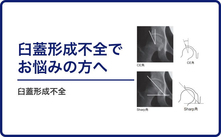 臼蓋形成不全でお悩みの方へ。