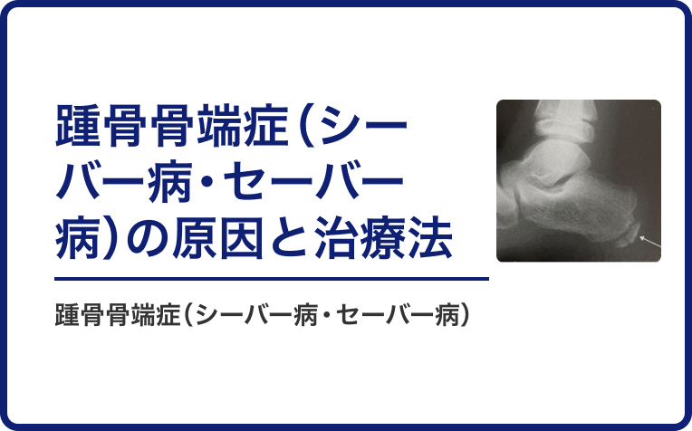 踵骨骨端症（シーバー病・セーバー病）の原因と治療法