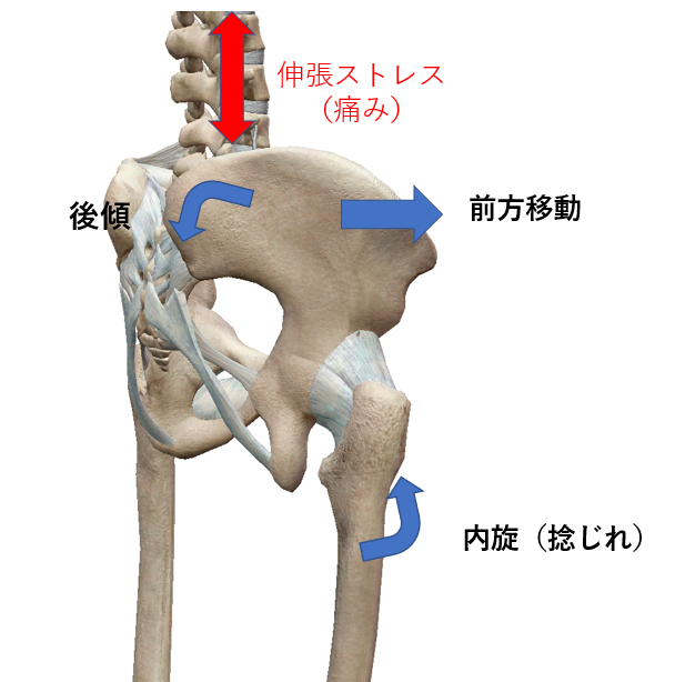 今日の新患さん 右腰と右太もも前面の痛み Hk Labo