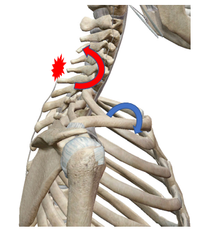 今日の新患さん 右首と左腰部の痛み とよあけ接骨院ケア