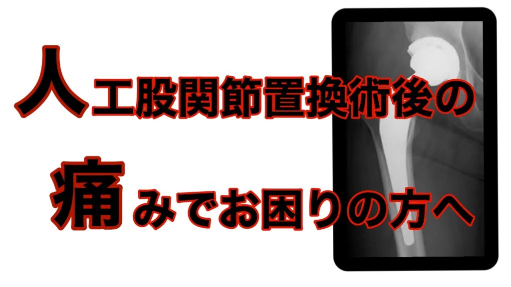 人工股関節置換術後(THA)の痛みがなかなかとれなくてお困りの方へ。