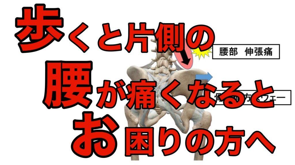 歩くといつも片側の腰が痛くなる方の原因と改善方法